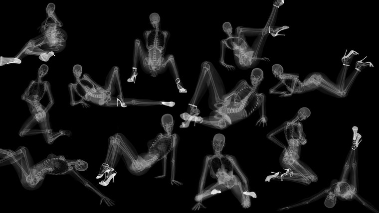X射线下的人体